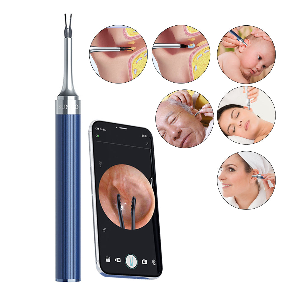 2-in-1 Visual Ear Wax Removal Tool with Ear Scoop Ear Tweezers Ear Cleaning Tool Blue
