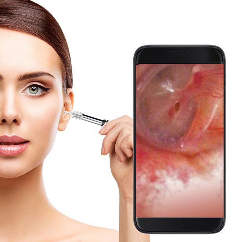 Ear Wax Removal Endoscope Earwax Remover Tool Ear Camera Ear Otoscope with 6 LED Lights -Black