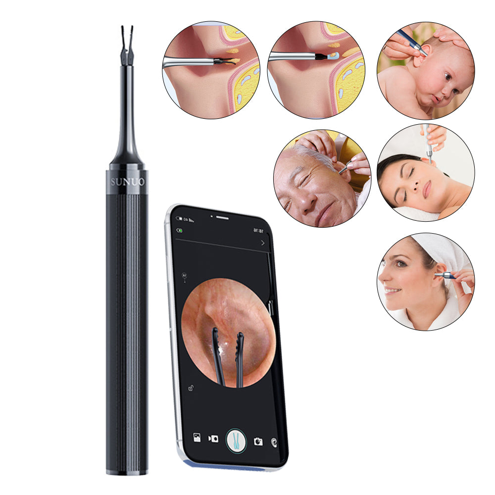 2-in-1 Visual Ear Wax Removal Tool with Ear Scoop Ear Tweezers Ear Cleaning Tool Black