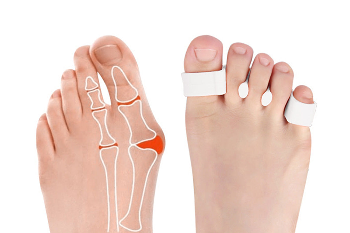 2 Pairs Five-Hole Toe Separators Bunion Corrector Pads for Foot Alignment and Pressure Relief-White