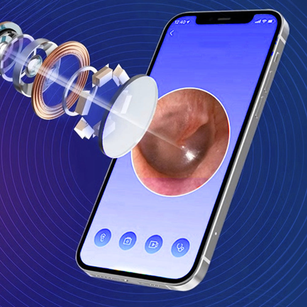Visual Ear Cleaner with Camera Ear Wax Removal-Blue