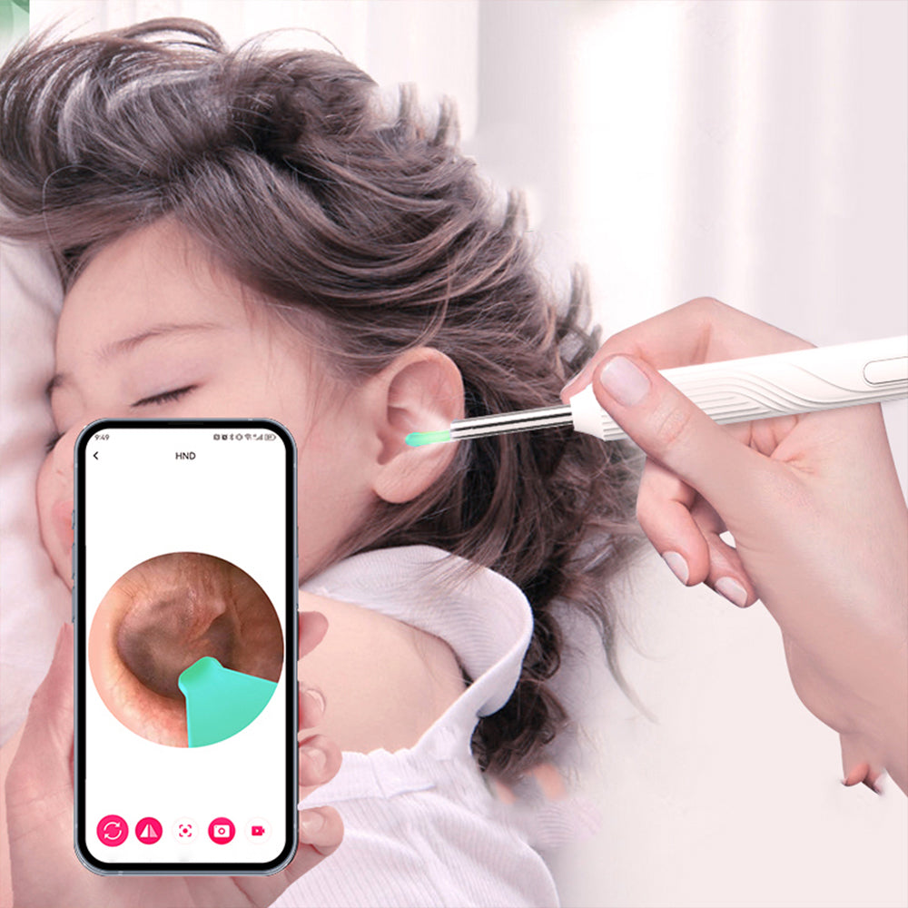 WiFi Wax Removal Tool Camera HD Ear Scope Otoscope with Light White