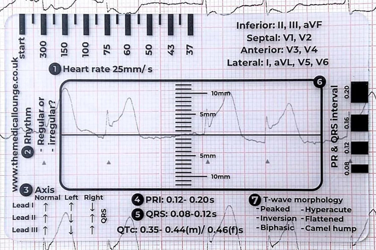 Portable ECG 7 Step Ruler Plastic Measuring Card Tool for ECG/EKG Interpretation
