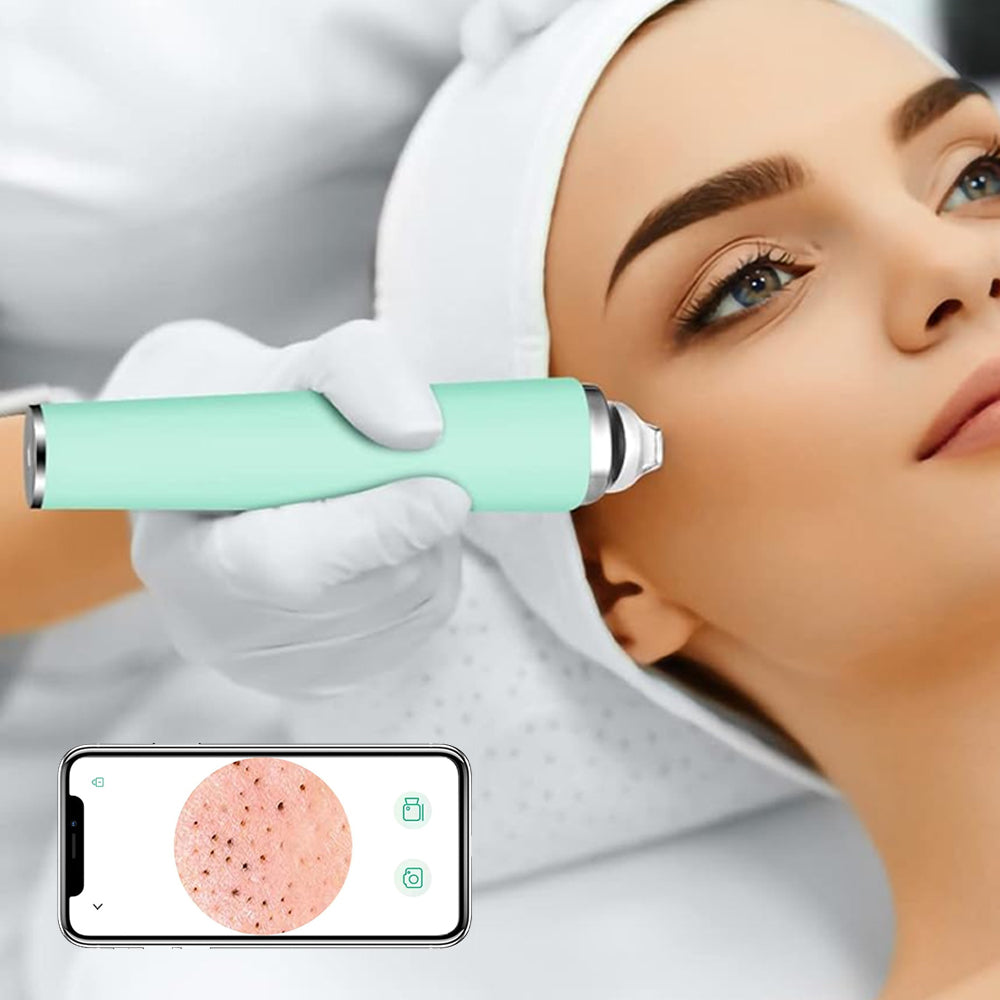 Blackhead Remover Pore Vacuum Visual Facial Pore Cleanser with 6 Suction Heads Green