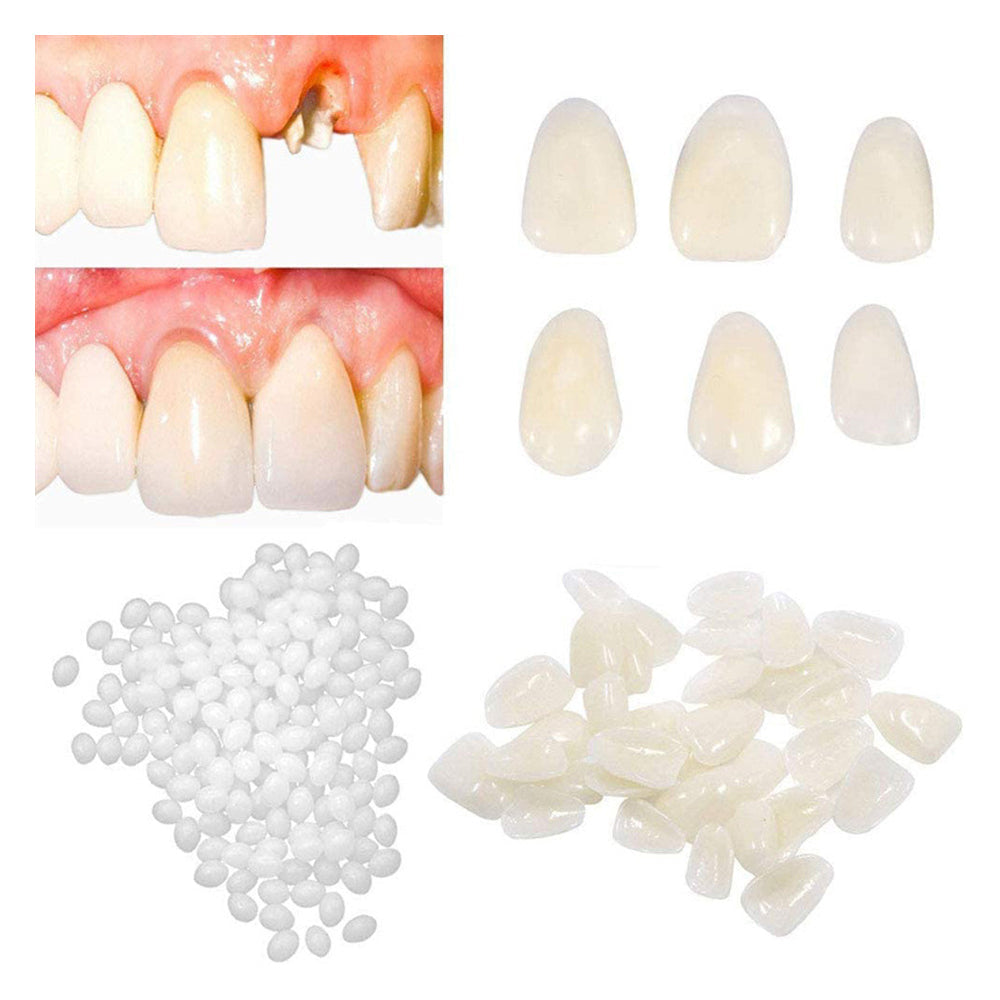 100Pcs Temporary Teeth Crown Smile Fake Teeth Veneer Teeth Repair Kit