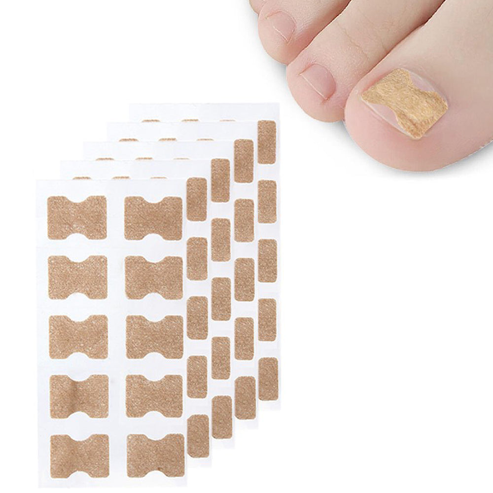 50Pcs Toenail Ingrown Correction Stickers