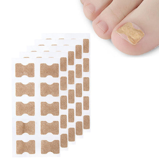 50Pcs Toenail Ingrown Correction Stickers