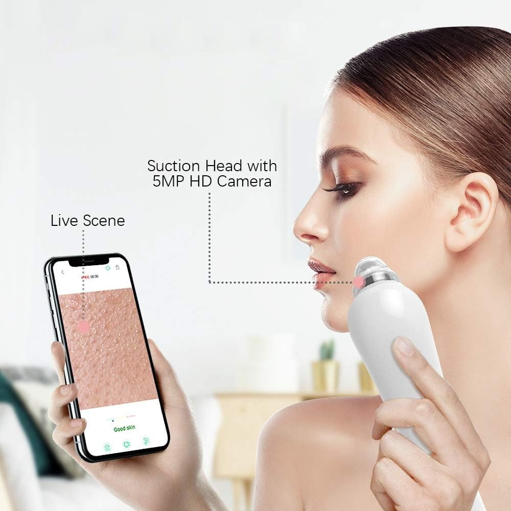 Blackhead Remover Pore Vacuum Visual Facial Pore Cleanser with 6 Suction Heads White