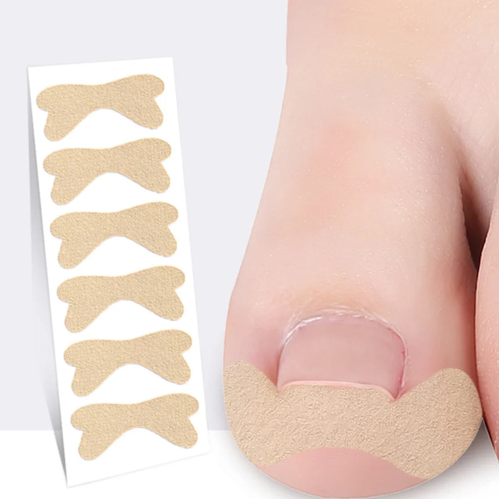 60Pcs Ingrown Toenail Strips Breathable Adhesive Toenail Stickers Patches