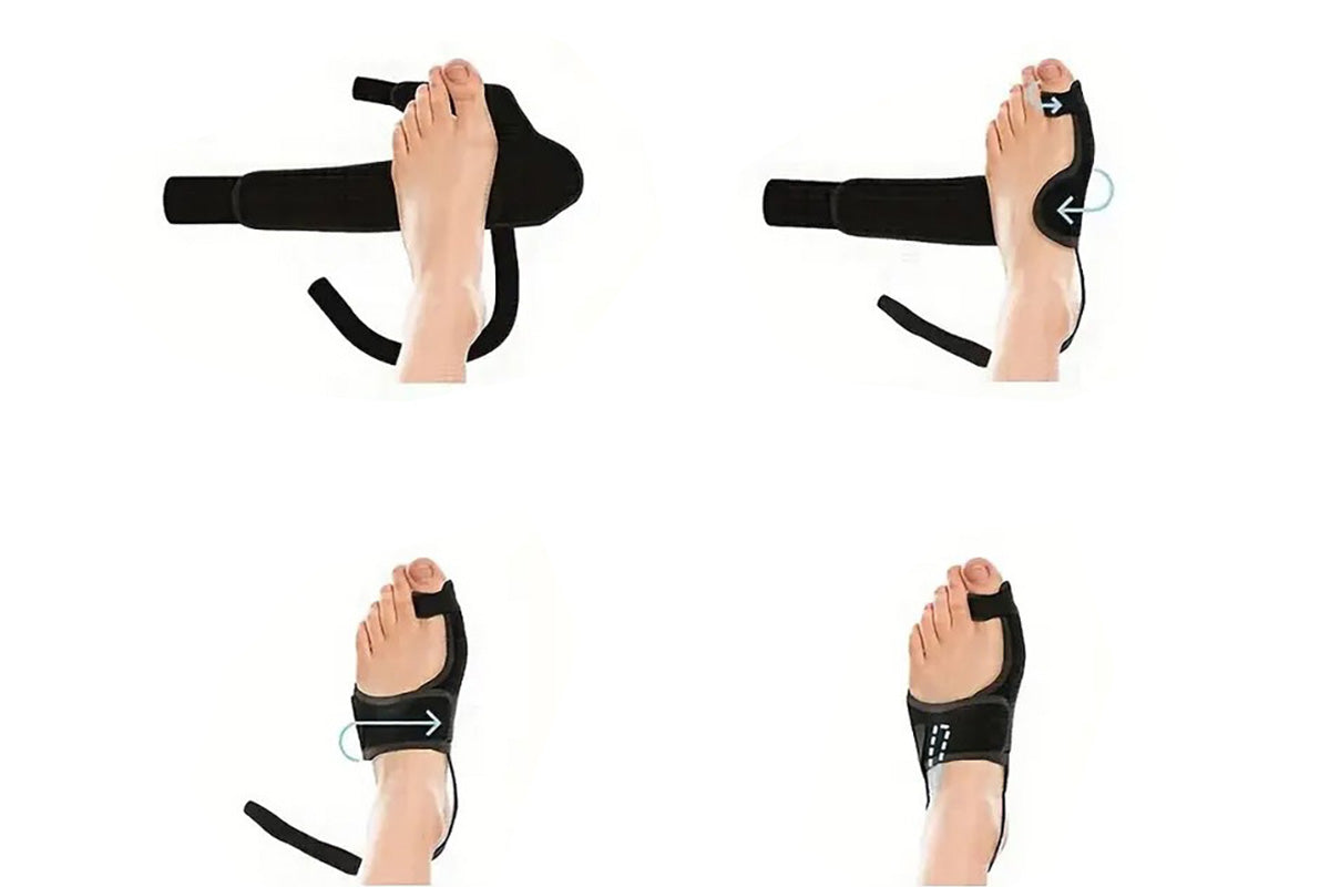 2PCS Bunion Corrector Adjustable Length Orthopedic Toe Separator for Men and Women