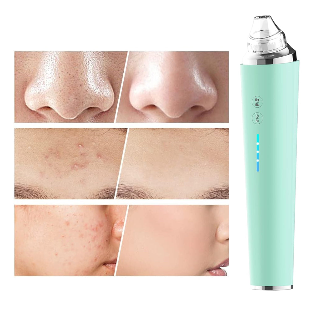 Blackhead Remover Pore Vacuum Visual Facial Pore Cleanser with 6 Suction Heads Green