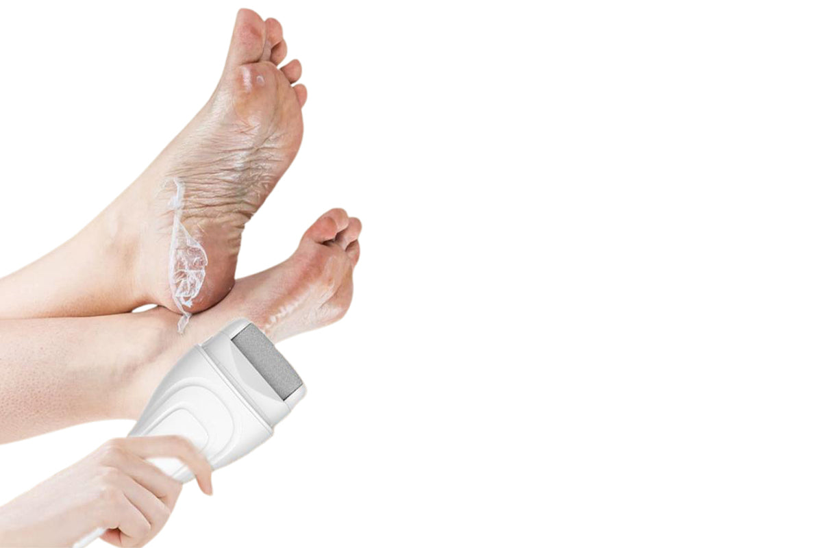 Electric Foot Callus Remover with LED Light Pedicure Tools for Dead Hard Cracked -White