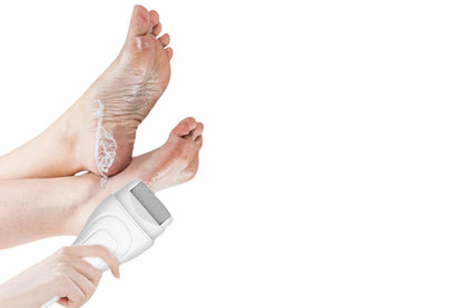Electric Foot Callus Remover with LED Light Pedicure Tools for Dead Hard Cracked -White