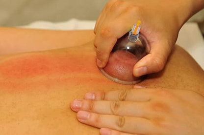 32Pcs Cupping Set with Pump Chinese Acupoint Cupping Therapy for Cellulite Reduction