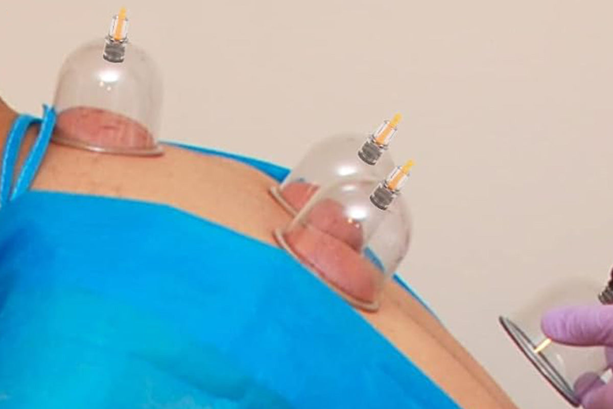 32Pcs Cupping Set with Pump Chinese Acupoint Cupping Therapy for Cellulite Reduction