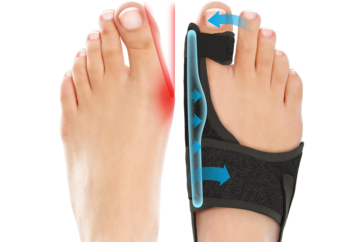 2PCS Bunion Corrector Adjustable Length Orthopedic Toe Separator for Men and Women