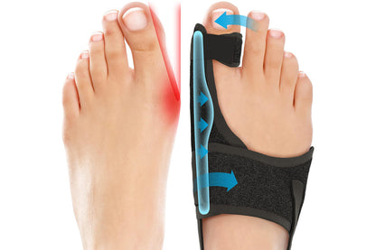 2PCS Bunion Corrector Adjustable Length Orthopedic Toe Separator for Men and Women