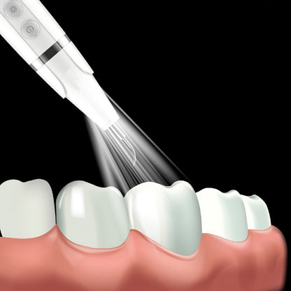 Electric Ultrasonic Plaque Remover Teeth Cleaning Kit Dental Calculus Remover LED Light -White