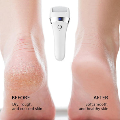 Electric Foot Callues Remover with 3 Replacement Heads Portable Pedicure Tool for Foot Care