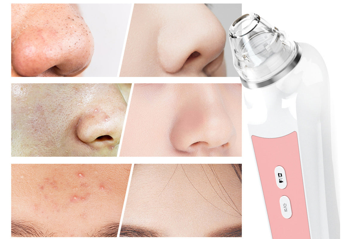 Blackhead Remover Tools with 6 Replacement Suction Heads Men and Women Pore Vacuum