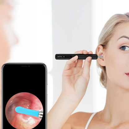 Wireless Otoscope Ear Wax Removal Kit Ear Cleaner with Light and Camera