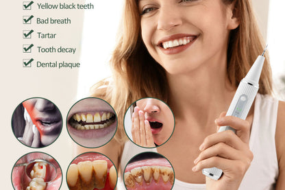 Teeth Cleaning Kit Tartar Remover with 4 Replaceable Heads Rechargeable Plaque Remover for Home