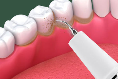 Teeth Cleaning Kit Tartar Remover with 4 Replaceable Heads Rechargeable Plaque Remover for Home