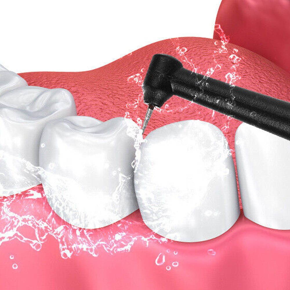 Electric Plaque Dental Calculus Remover Tooth Cleaner Dental Scaler Stain Remover Teeth Cleaning Kit