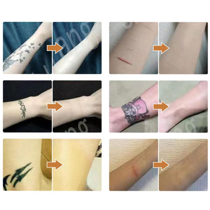 6Pcs Tattoo Scar Acne Cover Birthmark Cover Up Sticker Water Resistant Invisible Hide Tape