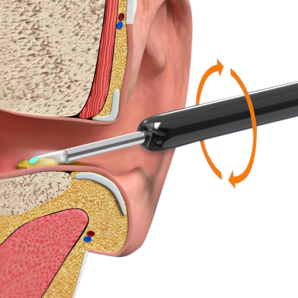 Wireless WiFi Ear Wax Removal Kit with HD Camera 360 Degree Visual Ear Cleaner-Black