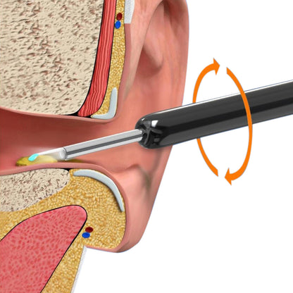 Wireless WiFi Ear Wax Removal Kit with HD Camera 360 Degree Visual Ear Cleaner-Black