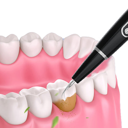 Ultrasonic Electric Tooth Cleaner Dental Calculus Remover Teeth Cleaning Kit LED Light-Black