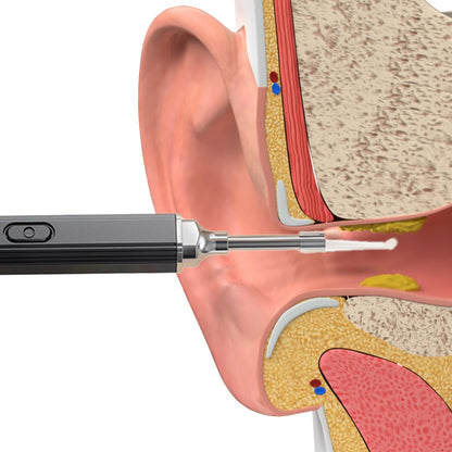 Ear Wax Removal Tool WiFi Ear Cleaning Kit with 3mm Visual Camera -Black