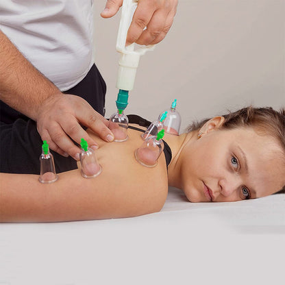 12Pcs Vacuum Cupping Cup Set Massage Kit Acupuncture Suction Massager