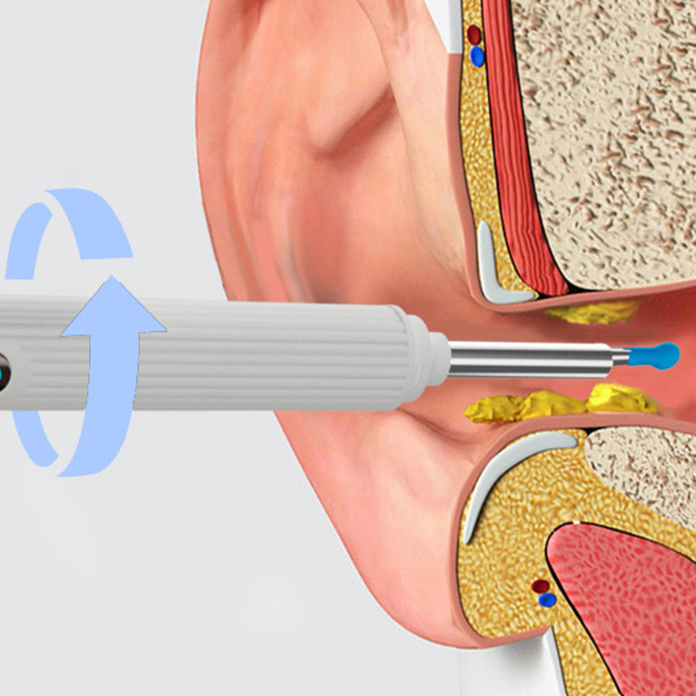 3.5mm Ear Wax Remover Tool Kits WiFi Ear Endoscope Wireless Otoscope with 6 LED Lights -White