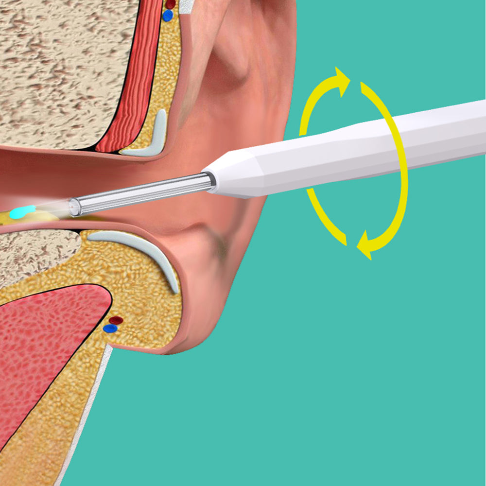 WIFI Connection Ear Wax Removal Tool Ear Set Camera Wireless Ear Endoscope Spoon -White