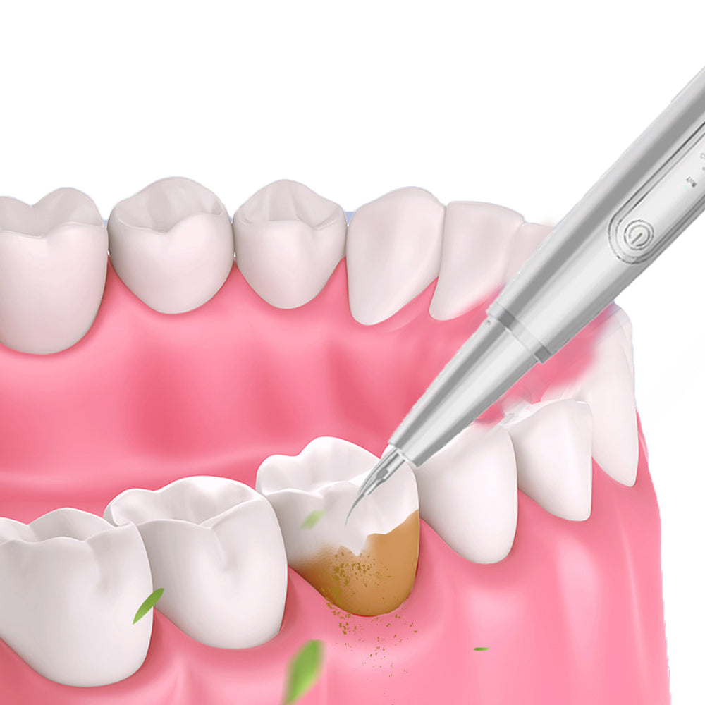 Ultrasonic Electric Tooth Cleaner Dental Calculus Remover Teeth Cleaning Kit LED Light-White