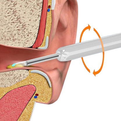 Wireless WiFi Ear Wax Removal Kit with HD Camera 360 Degree Visual Ear Cleaner-White