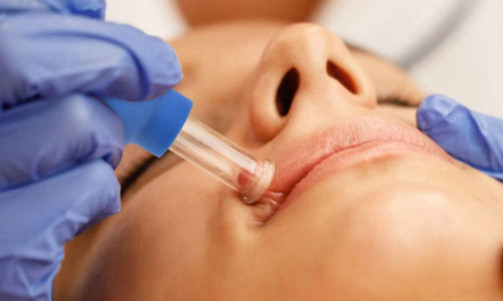 4 Pcs Facial and Body Cupping Therapy Set