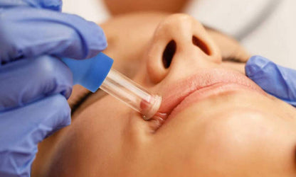 4 Pcs Facial and Body Cupping Therapy Set